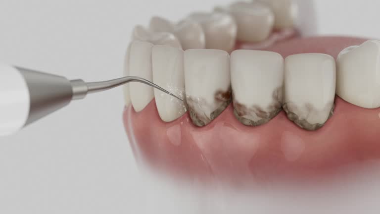 Reliable Dental contractor in Altadena, CA by Smile Center Dentistry